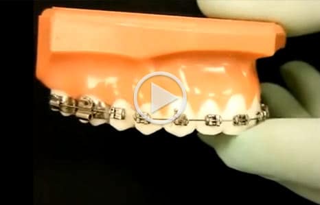 Emergency Care Video Twelve Corners Orthodontics & Pediatric Dentistry in Rochester, NY
